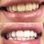 Load image into Gallery viewer, Glory Smile - élimine les odeurs, taches et blanchit les dents (Résultat Garantie - Dernières pièces restantes)
