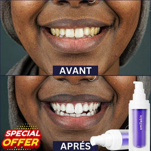 Glory Smile - élimine les odeurs, taches et blanchit les dents (Résultat Garantie - Dernières pièces restantes)