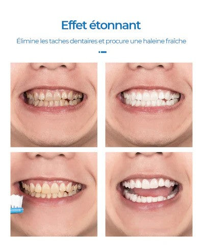 LANBENA-Mousse de blanchiment des dents  (EN PROMOTION - Stock très limité)