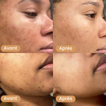 Load image into Gallery viewer, Masque au collagène - Anti taches, bouton, visage gras (PROMO FÊTE DES MÈRES  - Stock presqu&#39;épuisé)
